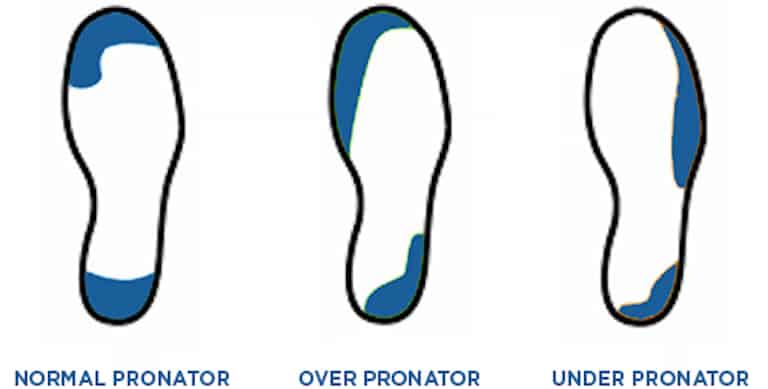 Graphic showing the normal, over and under pronator.